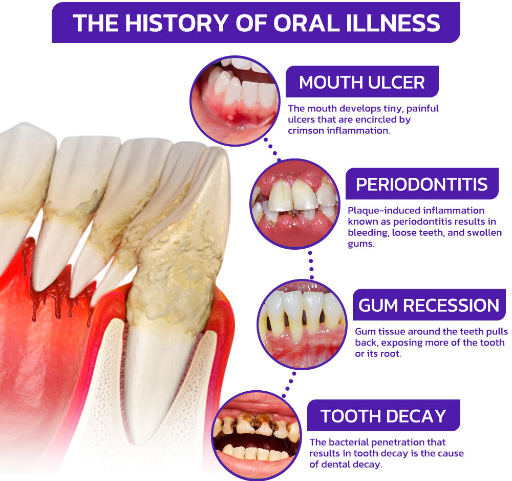 🇬🇧👨🏼⚕️Rolimey® VioGloss Bee Venom Dental Therapy Oral Power🦷