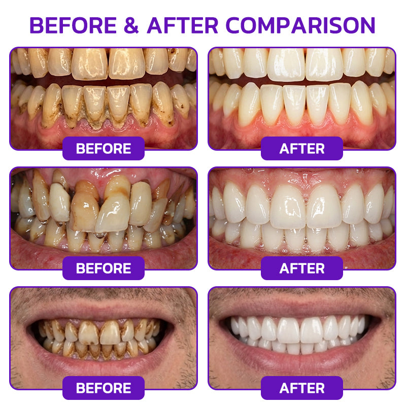 Rolimey® VioCore Bee Venom Gingivitis & Periodontitis Treatment Toothpaste