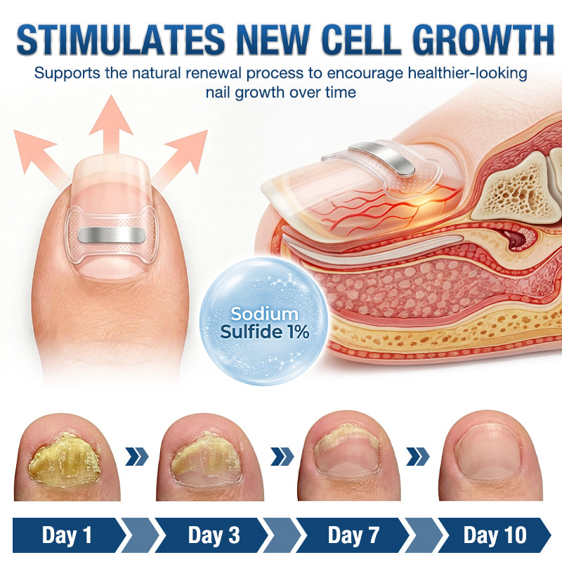Evolvion® Ingrown Toenail Corrector Nail Renewal Patches