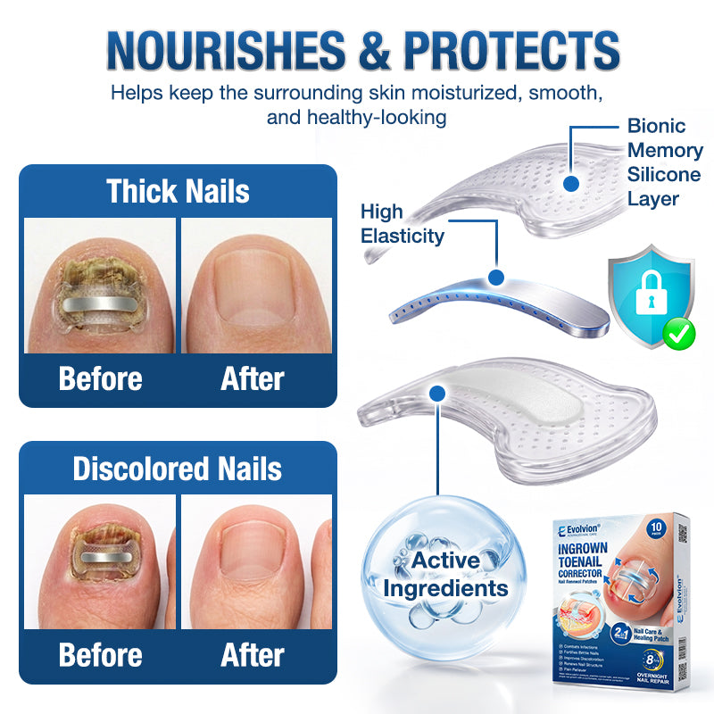 Evolvion® Ingrown Toenail Corrector Nail Renewal Patches