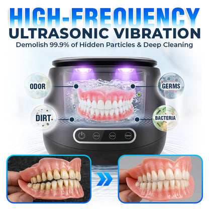 Rolimey® 25W Deep Cleaning Denture Ultrasonic Cleaner for Retainers, Mouth Guards, Aligner