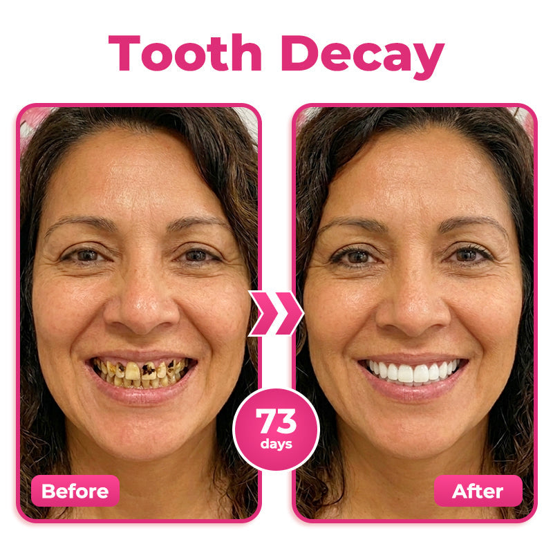 ⭐️Rolimey® Thismile NH-10 Enamel & Gum Advanced Therapy Toothpaste Serum