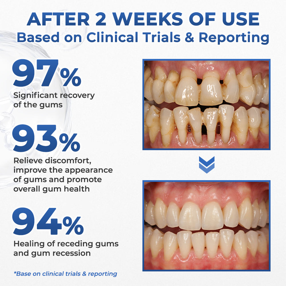 Rolimey® Bio-Probiotic SP-6 Gum Therapy Brightening Dental Toothpaste
