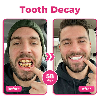 ⭐️Rolimey® Thismile NH-10 Enamel & Gum Advanced Therapy Toothpaste Serum