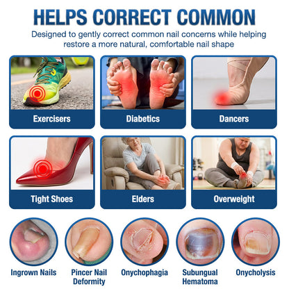 Evolvion® Ingrown Toenail Corrector Nail Renewal Patches