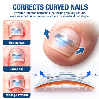 Evolvion® Ingrown Toenail Corrector Nail Renewal Patches