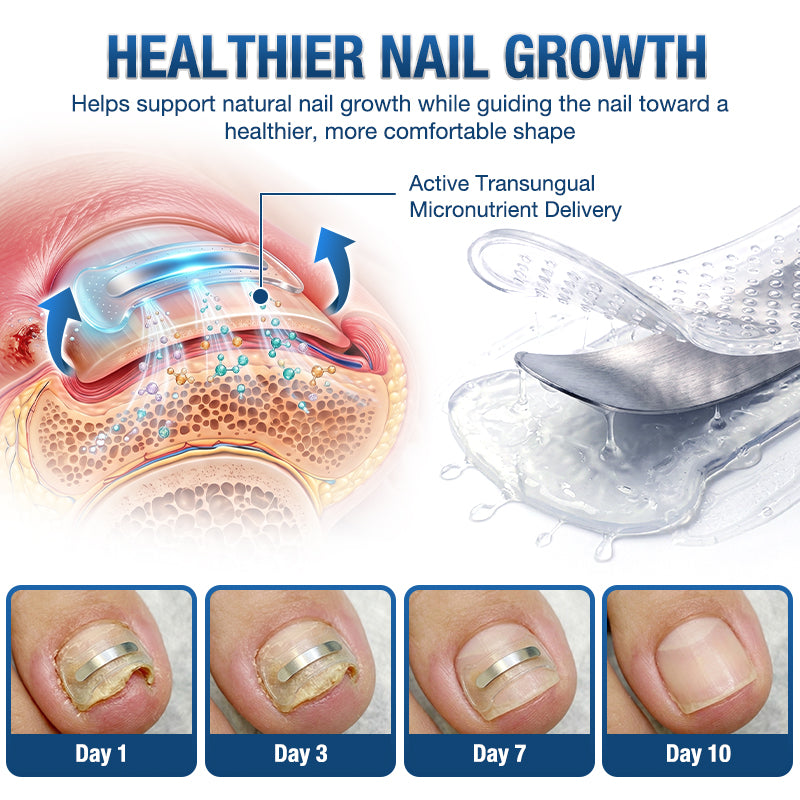 Evolvion® Ingrown Toenail Corrector Nail Renewal Patches