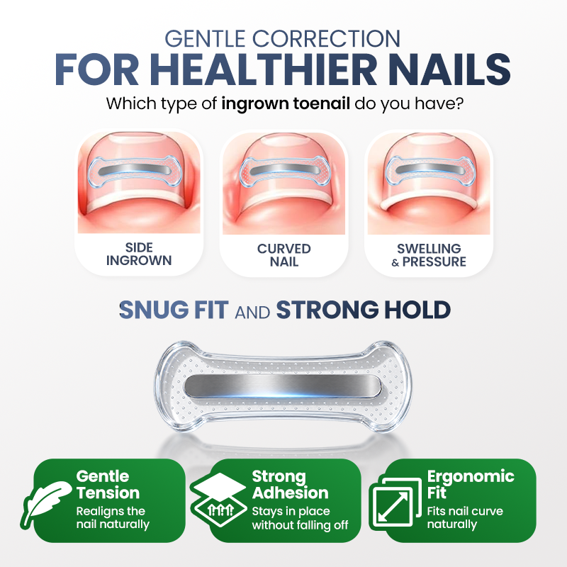 Evolvion® Ingrown Nail Relief & Correction Strips
