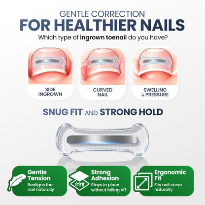 Evolvion® Ingrown Nail Relief & Correction Strips