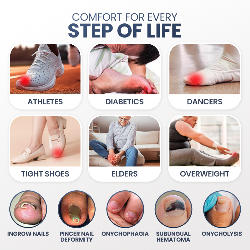 Evolvion® Ingrown Nail Relief & Correction Strips