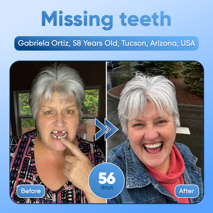 ⭐️Tideglusib Fast‑Dissolving Tooth & Gum Repair Oral Strips