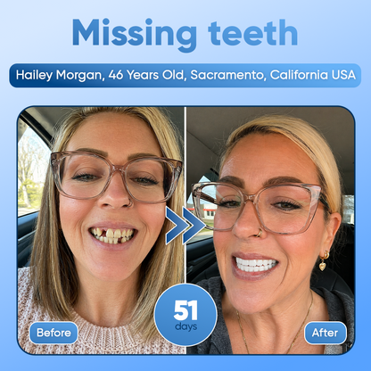 ⭐️Tideglusib Fast‑Dissolving Tooth & Gum Repair Oral Strips