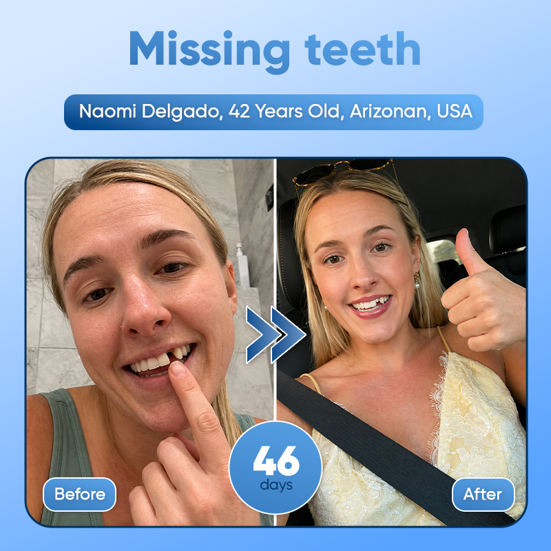 ⭐️Tideglusib Fast‑Dissolving Tooth & Gum Repair Oral Strips