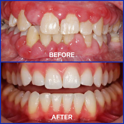 Rolimey® VioCore Bee Venom Dental Treatment Lysozyme Toothpaste🦷